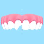 chipped or crooked teeth