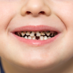 how can i prevent Cavities in my child, and how often should i take my child for a dental visit