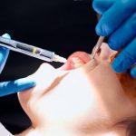 dentist treating gum recession